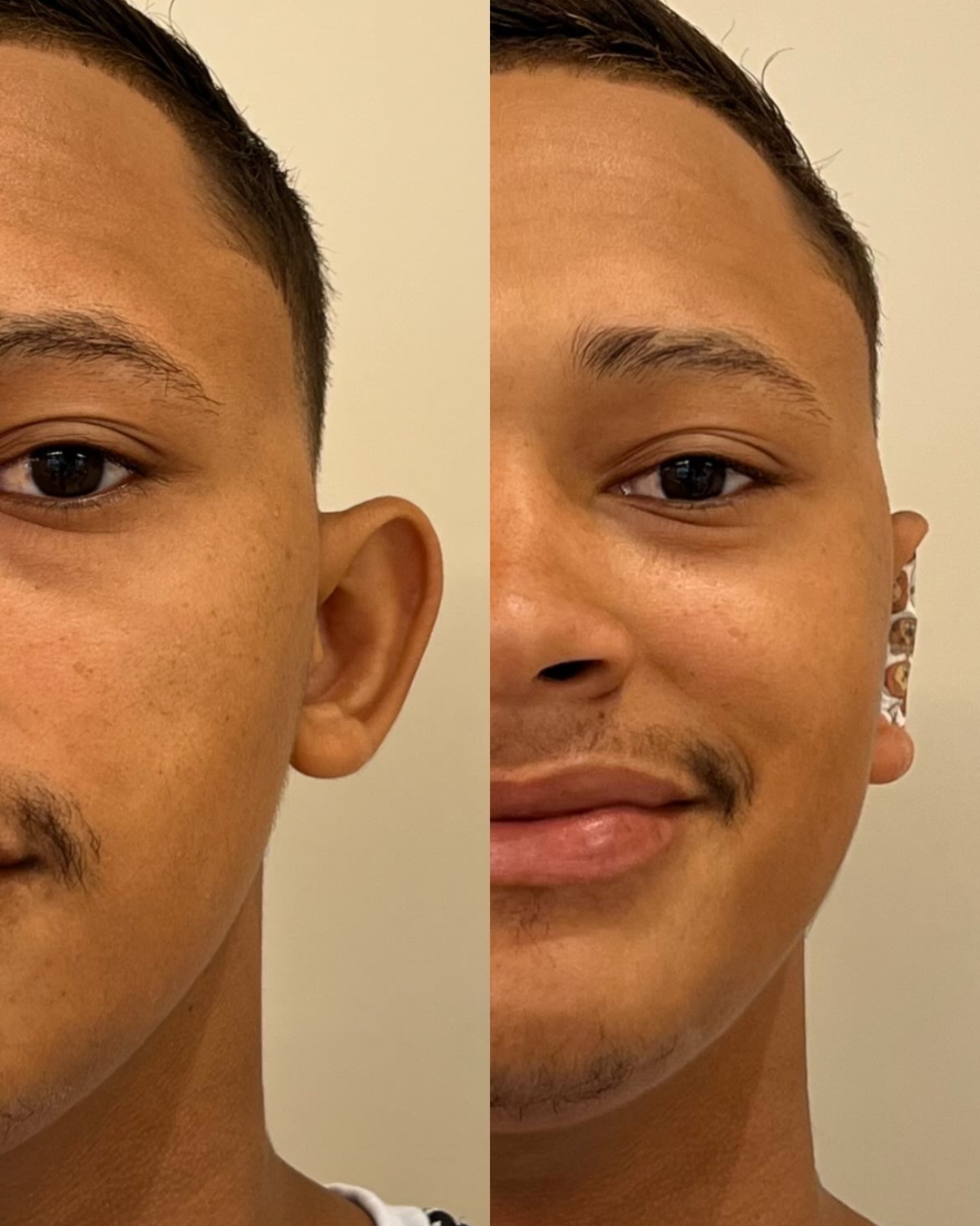 24